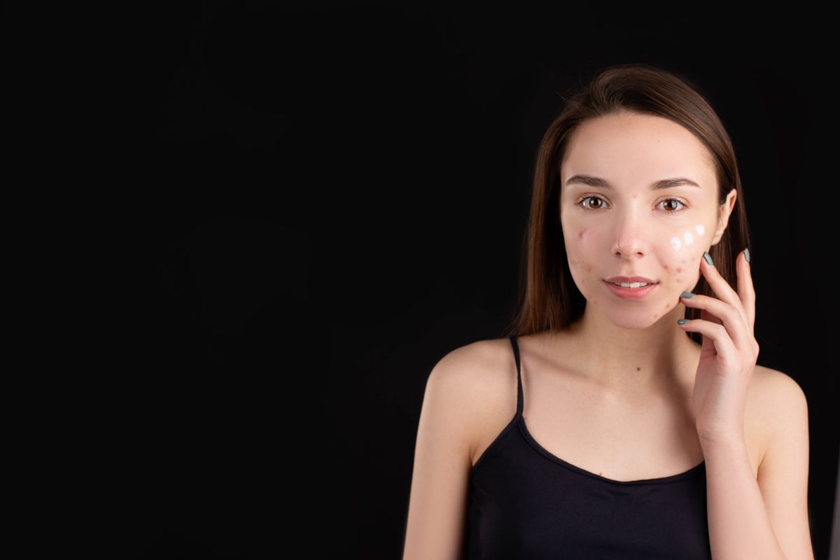 A young person with acne looking in a bathroom mirror